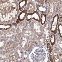 DBT Antibody, Novus Biologicals:Antibodies:Primary Antibodies