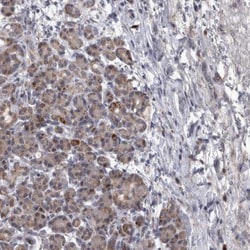 DBT Antibody, Novus Biologicals:Antibodies:Primary Antibodies