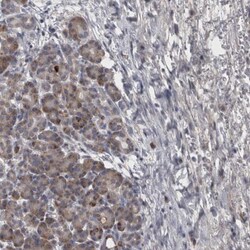 DBT Antibody, Novus Biologicals:Antibodies:Primary Antibodies