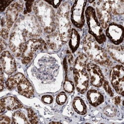 DBT Antibody, Novus Biologicals 0.1mL; Unlabeled:Antibodies, Polyclonal