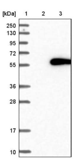 DBT Antibody, Novus Biologicals:Antibodies:Primary Antibodies