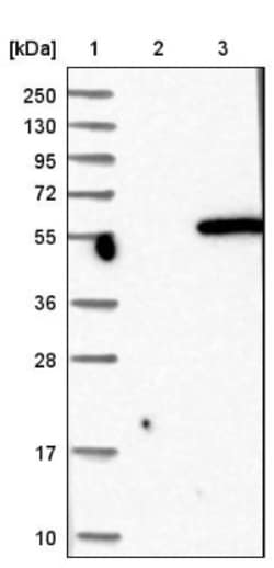 DBT Antibody, Novus Biologicals:Antibodies:Primary Antibodies