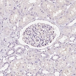 DC-LAMP Antibody, Novus Biologicals:Antibodies:Primary Antibodies