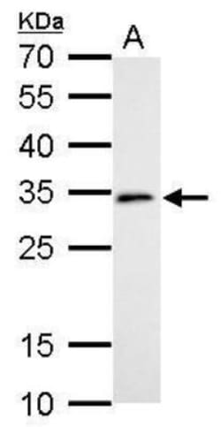 anti-DC8, Polyclonal, Novus Biologicals 0.1mg; Unlabeled:Antibodies, Polyclonal