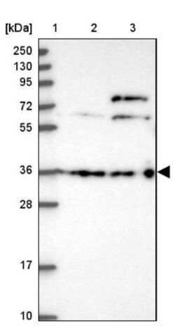 DCAF4 Antibody, Novus Biologicals 25 &mu;L | Buy Online | Novus Biologicals | Fisher Scientific