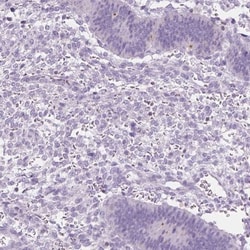 DCAF8L1 Antibody, Novus Biologicals:Antibodies:Primary Antibodies