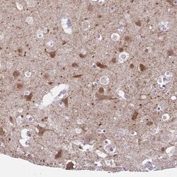 DCAMKL2 Antibody, Novus Biologicals:Antibodies:Primary Antibodies