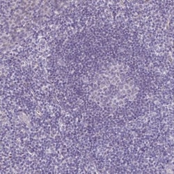 DCAMKL2 Antibody, Novus Biologicals:Antibodies:Primary Antibodies