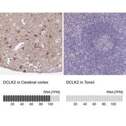 DCAMKL2 Antibody, Novus Biologicals:Antibodies:Primary Antibodies