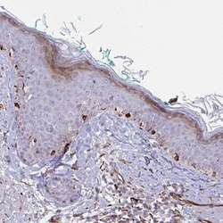 DCBLD1 Antibody, Novus Biologicals 0.1mL; Unlabeled:Antibodies, Polyclonal