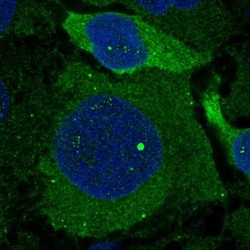 DCDC2 Antibody, Novus Biologicals 0.1mL; Unlabeled:Antibodies, Polyclonal