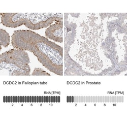 DCDC2 Antibody, Novus Biologicals 0.1mL; Unlabeled:Antibodies, Polyclonal