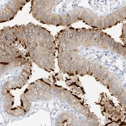 DCDC2 Antibody, Novus Biologicals 25 &mu;L, Unlabeled:Antibodies, Polyclonal