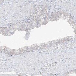 DCDC2 Antibody, Novus Biologicals 25 &mu;L, Unlabeled:Antibodies, Polyclonal