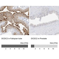 DCDC2 Antibody, Novus Biologicals 25 &mu;L, Unlabeled:Antibodies, Polyclonal