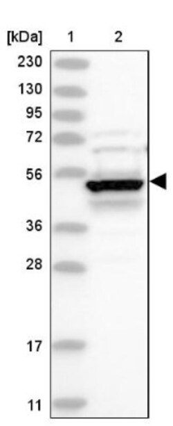 DCDC2 Antibody, Novus Biologicals 25 &mu;L, Unlabeled:Antibodies, Polyclonal