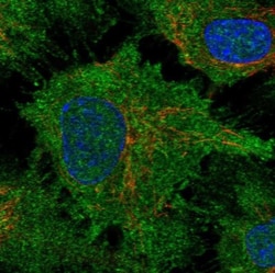 DCHS1 Antibody, Novus Biologicals 25 &mu;L, Unlabeled:Antibodies, Polyclonal