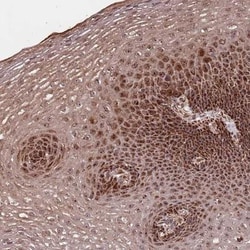 DCHS1 Antibody, Novus Biologicals 25 &mu;L, Unlabeled:Antibodies, Polyclonal