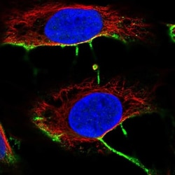 DCHS2 Antibody, Novus Biologicals 25 &mu;L, Unlabeled:Antibodies, Polyclonal