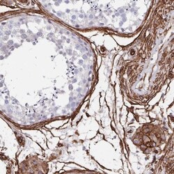 DCHS2 Antibody, Novus Biologicals 25 &mu;L, Unlabeled:Antibodies, Polyclonal