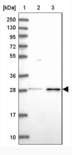 DCI Antibody, Novus Biologicals 25 &mu;L, Unconjugated:Antibodies, Polyclonal