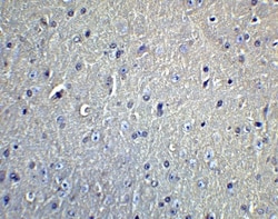 DCLK1 Antibody - BSA Free, Novus Biologicals 0.1mg; Unlabeled:Antibodies,