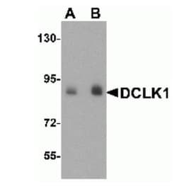 DCLK1 Antibody - BSA Free, Novus Biologicals 0.1mg; Unlabeled:Antibodies,