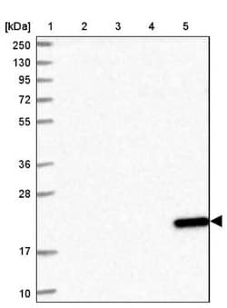 DCTN5 Antibody, Novus Biologicals 0.1mL; Unlabeled:Antibodies, Polyclonal