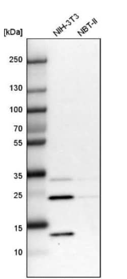 DCUN1D4 Antibody, Novus Biologicals 25 &mu;L; Unlabeled:Antibodies, Polyclonal