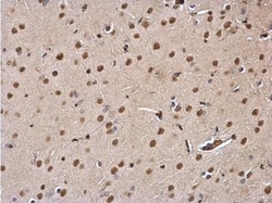 DDB1 Antibody, Novus Biologicals 0.1mL; Unlabeled:Antibodies, Polyclonal