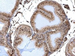 DDB1 Antibody, Novus Biologicals 0.1mL; Unlabeled:Antibodies, Polyclonal