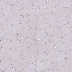 DDHD1 Antibody, Novus Biologicals:Antibodies:Primary Antibodies