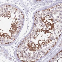 DDHD1 Antibody, Novus Biologicals:Antibodies:Primary Antibodies