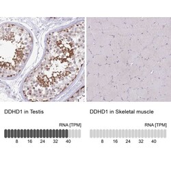 DDHD1 Antibody, Novus Biologicals:Antibodies:Primary Antibodies