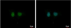 DDI1 Antibody, Novus Biologicals 0.1mg; Unlabeled:Antibodies, Polyclonal