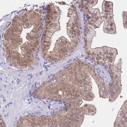 DDI2 Antibody, Novus Biologicals:Antibodies:Primary Antibodies