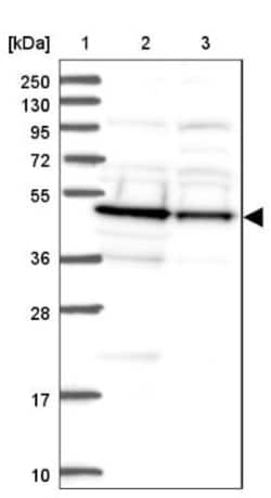 DDI2 Antibody, Novus Biologicals:Antibodies:Primary Antibodies