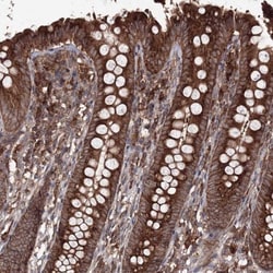DDO Antibody, Novus Biologicals 25 &mu;L; Unlabeled:Antibodies, Polyclonal