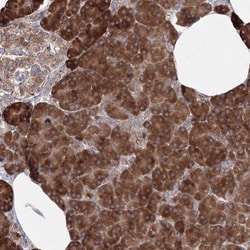 DDO Antibody, Novus Biologicals 0.1mL; Unlabeled:Antibodies, Polyclonal