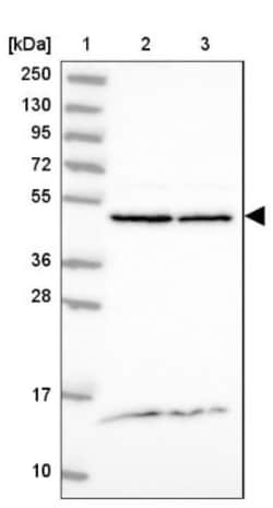 DDOST Antibody, Novus Biologicals 25 &mu;L, Unlabeled:Antibodies, Polyclonal