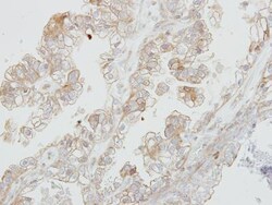 DDR1 Antibody, Novus Biologicals 0.1mg; Unlabeled:Antibodies, Polyclonal