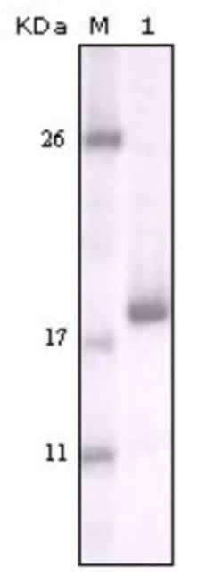 DDR2 Antibody (3B11E4), Novus Biologicals 0.1mL; Unlabeled:Antibodies,