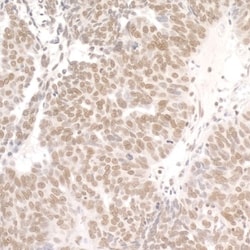 DDX1 Antibody, Novus Biologicals 0.1mL; Unlabeled:Antibodies, Polyclonal