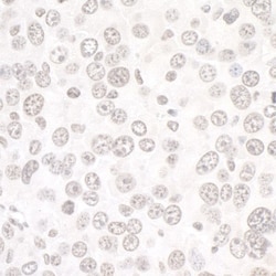 DDX1 Antibody, Novus Biologicals 0.1mL; Unlabeled:Antibodies, Polyclonal