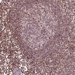 DDX11 Antibody, Novus Biologicals:Antibodies:Primary Antibodies