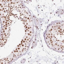 DDX17 Antibody, Novus Biologicals 25 &mu;L | Buy Online | Novus Biologicals | Fisher Scientific