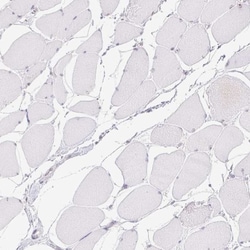 DDX17 Antibody, Novus Biologicals 25 &mu;L | Buy Online | Novus Biologicals | Fisher Scientific