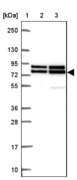 DDX17 Antibody, Novus Biologicals 25 &mu;L | Buy Online | Novus Biologicals | Fisher Scientific