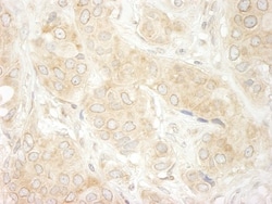 DDX19B Antibody, Novus Biologicals 0.1mL; Unlabeled:Antibodies, Polyclonal