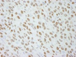 DDX21 Antibody - BSA Free, Novus Biologicals 0.025mL; Unlabeled:Antibodies,